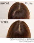 scalp serum