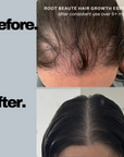 Scalp Hair Essence (Promotes Hair Growth)