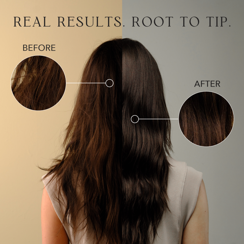 Gentle Botanical Daily Scalp Shampoo with Amino Acids: What to Look For and Why Root Beaute Gets It Right