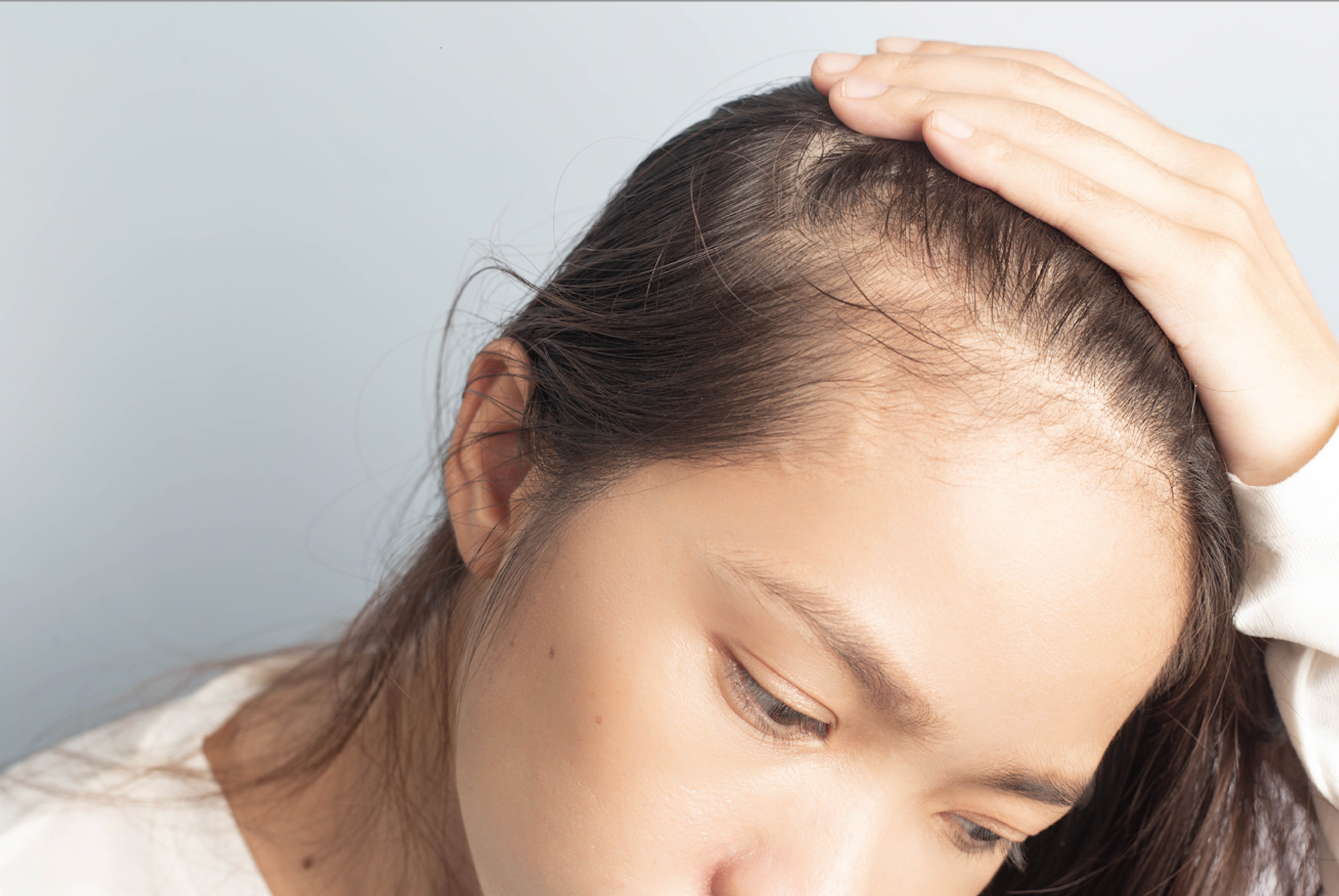 Oily Scalp but Dry Hair? Here’s What’s Happening